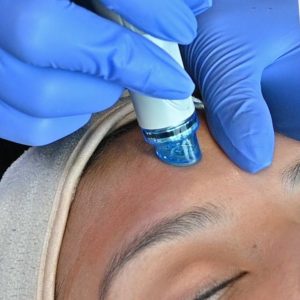 HYDRAFACIAL Treatments