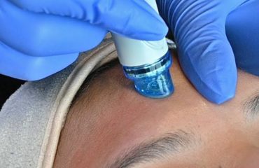 HYDRAFACIAL Treatments